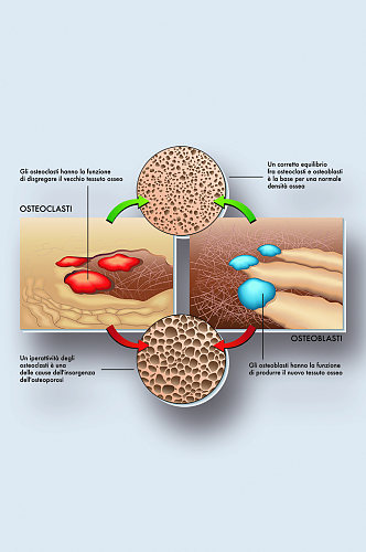 人体破骨细胞病症解析图医学器官解剖插图