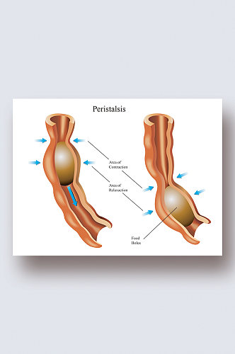 肠道蠕动医学人体器官组织解剖插图元素