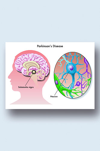 大脑神经医学人体器官组织解剖插图元素