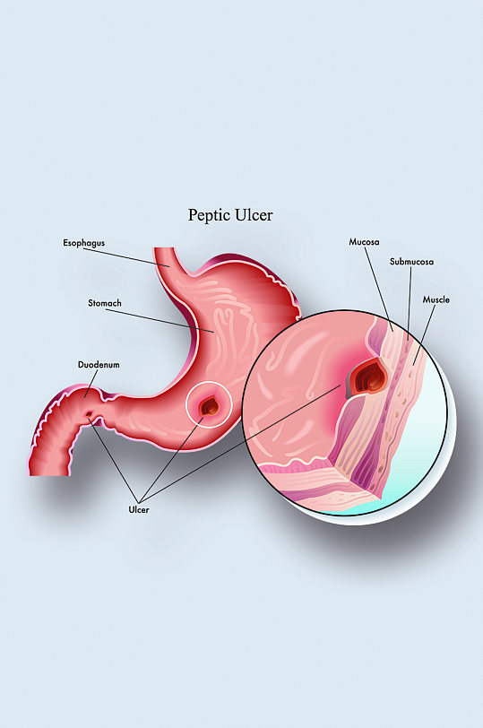 胃截面图医学人体器官组织解剖插图元素