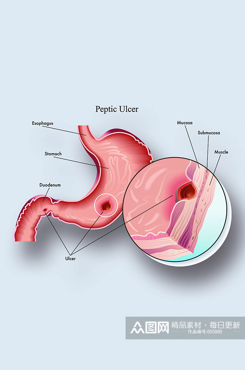 胃截面图医学人体器官组织解剖插图元素素材