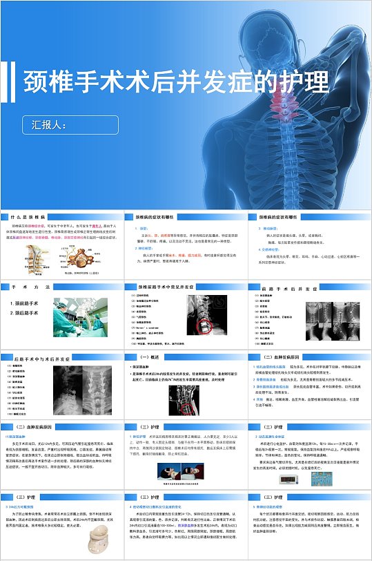 頸椎手術(shù)術(shù)后并發(fā)癥的護理PPT