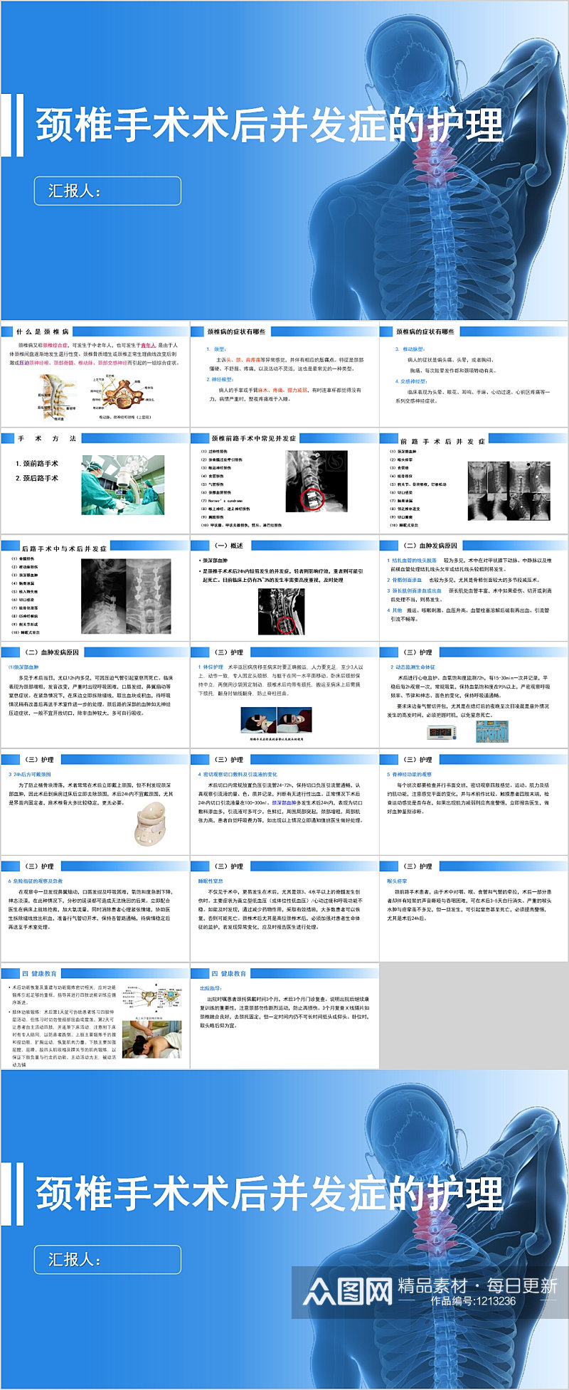 颈椎手术术后并发症的护理PPT素材