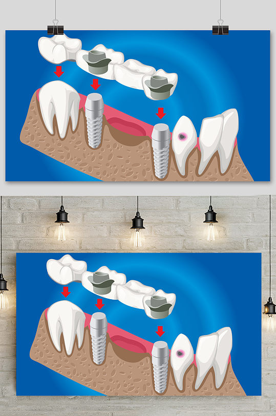 手绘卡通牙齿治疗矢量元素