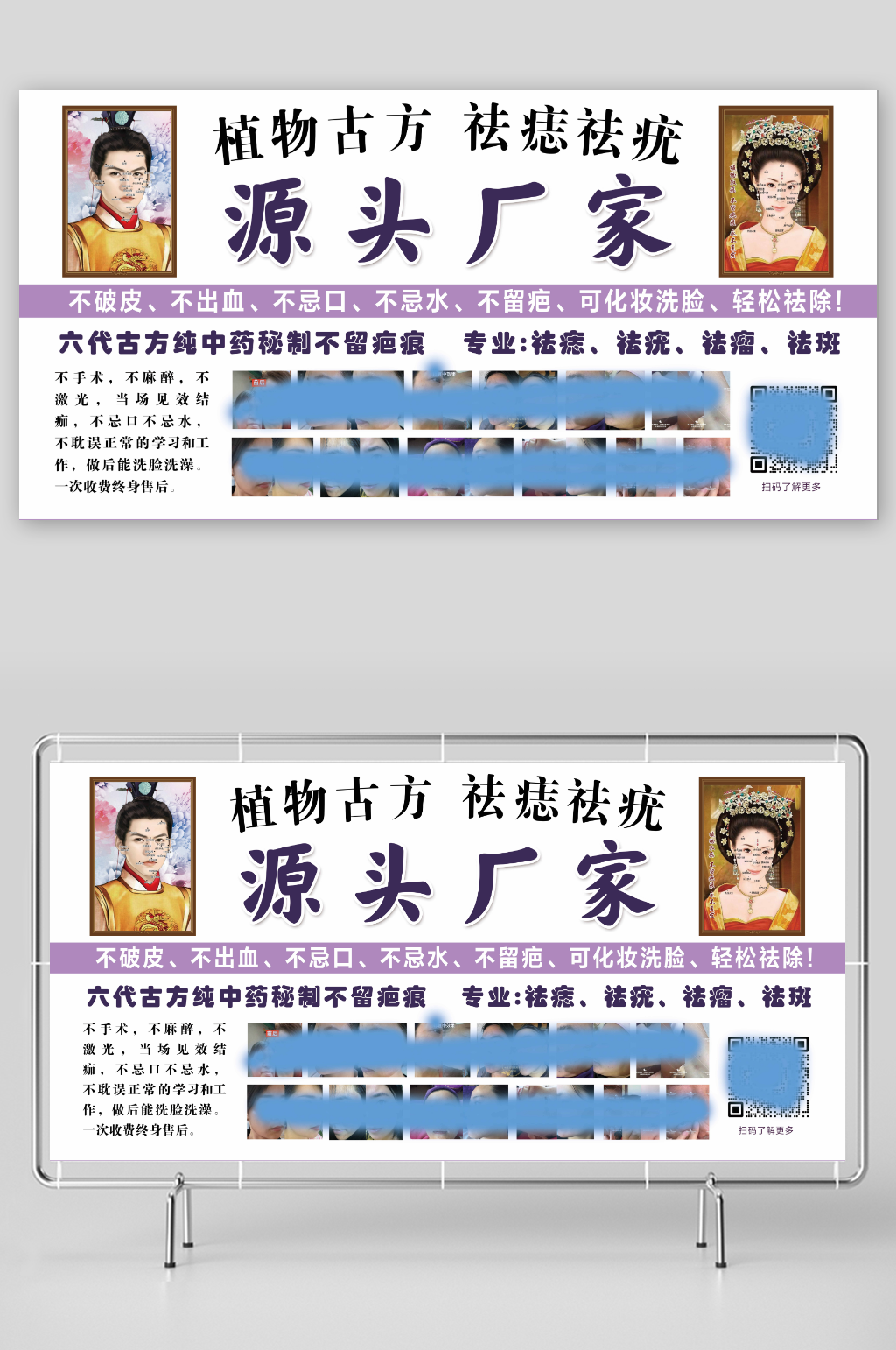 美容祛痣宣传喷绘海报素材