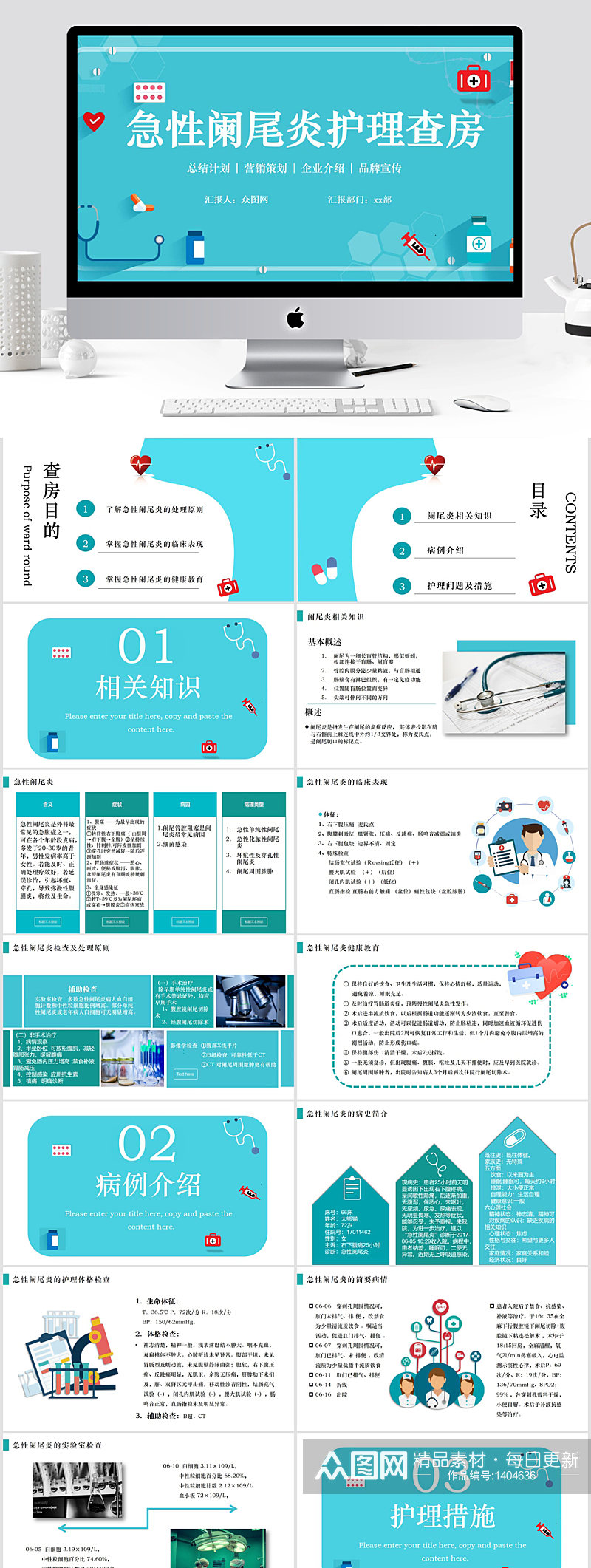 急性阑尾炎护理查房治疗PPT模板素材