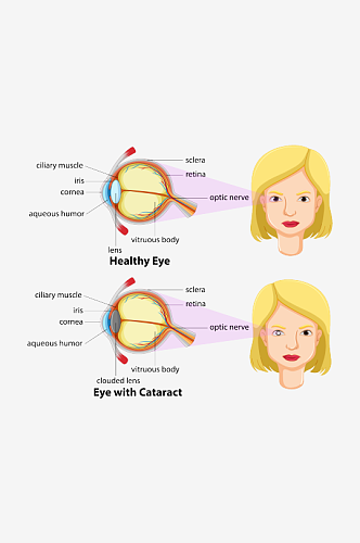 眼球健康对比图插画元素设计元素