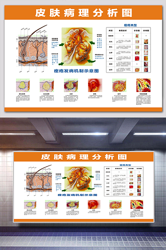 痘痘皮肤病理分析图