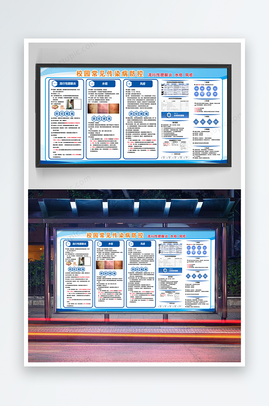 校园常见传染病防控流行性腮腺炎水痘