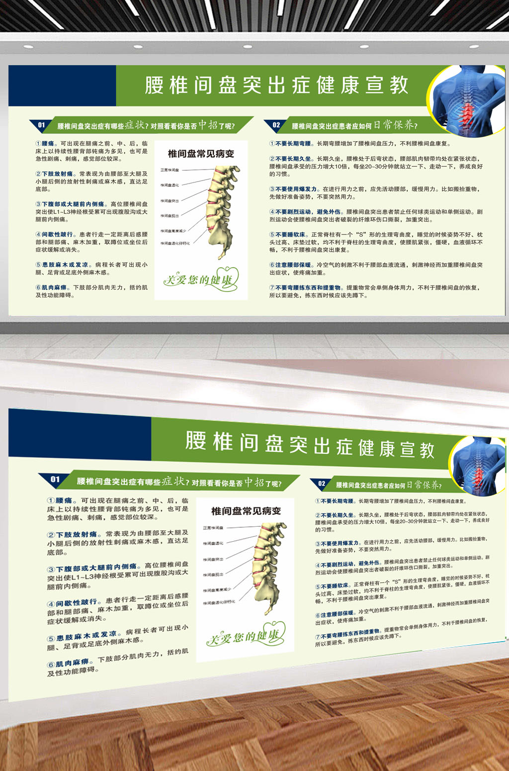 腰椎间盘突出症健康宣教