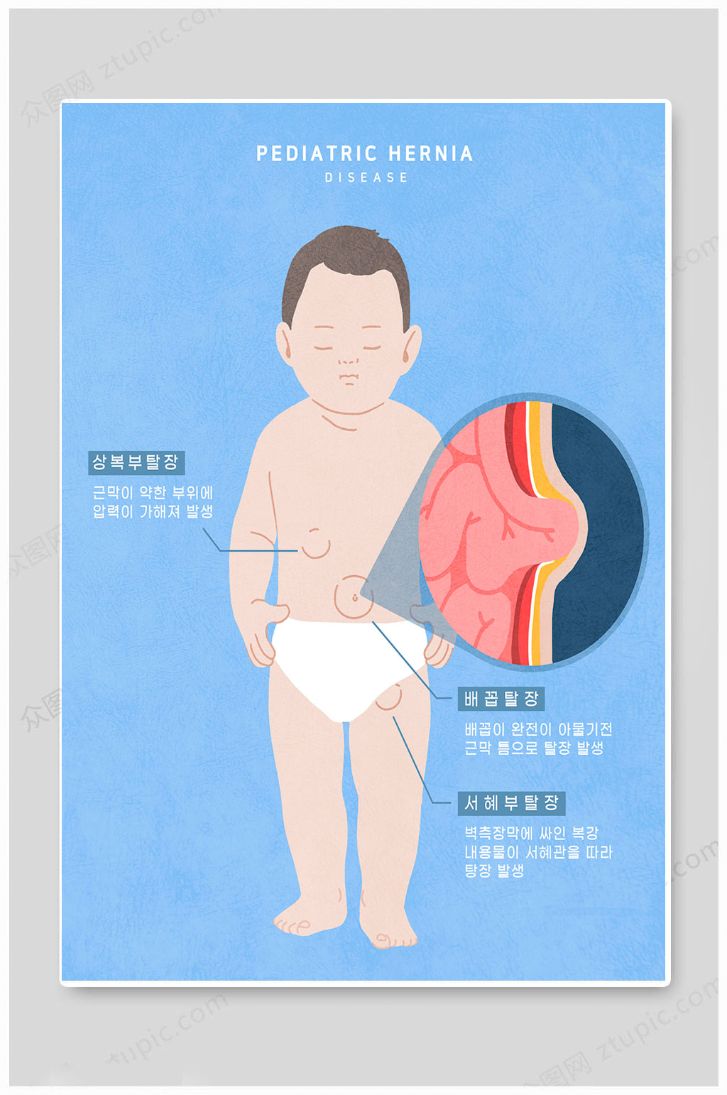 大氣幼兒手足口病宣傳海報素材