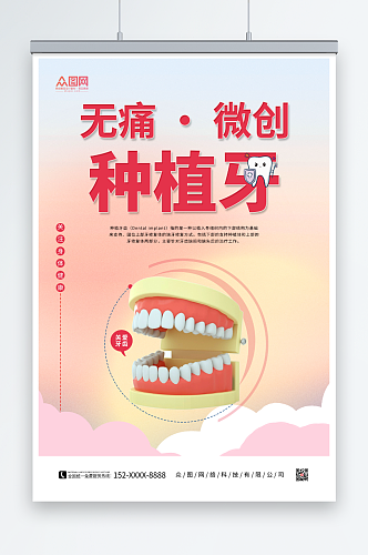微创种植牙牙科口腔海报