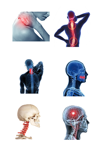 颈椎病疼痛医疗健康低头免抠元素