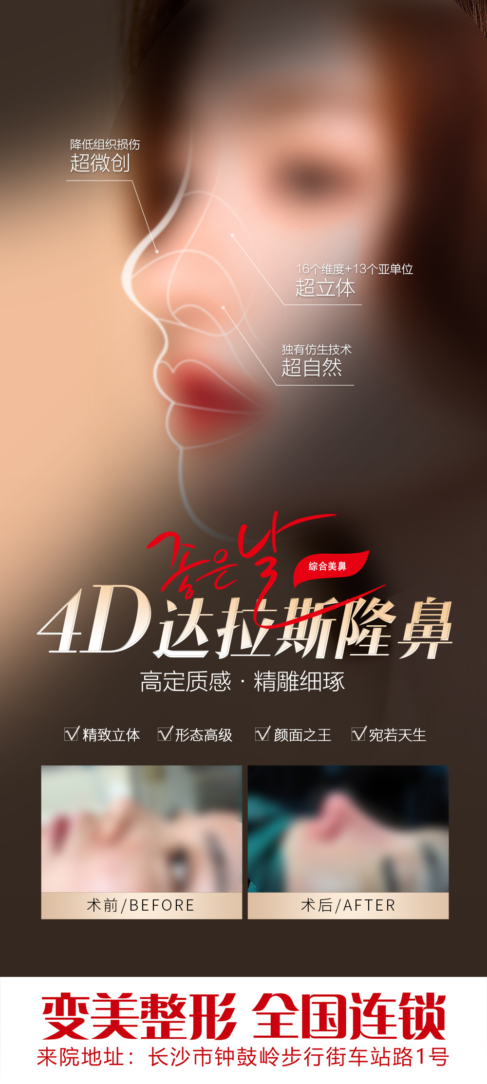 医美综合隆鼻案例海报素材