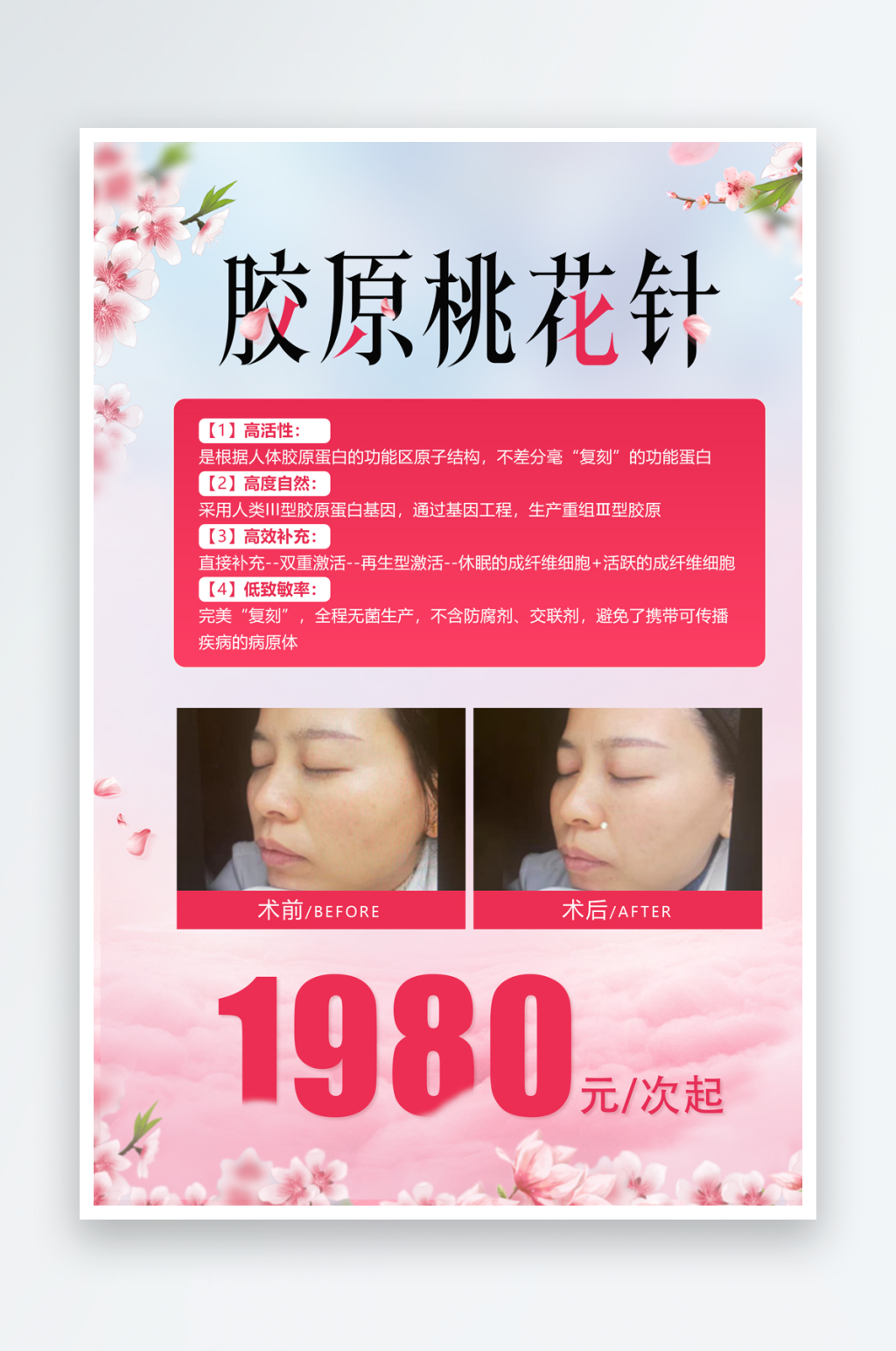 胶原桃花针案例对比价格素材