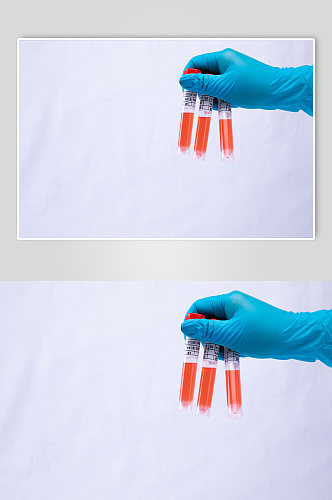 核酸检测管医用手套西医防护物品摄影图片