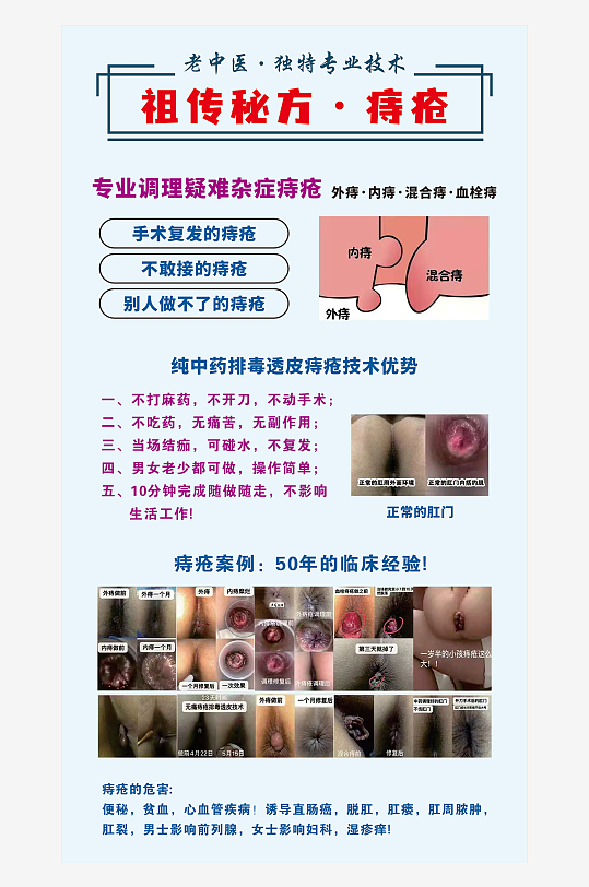 祖传秘方痔疮海报-众图网