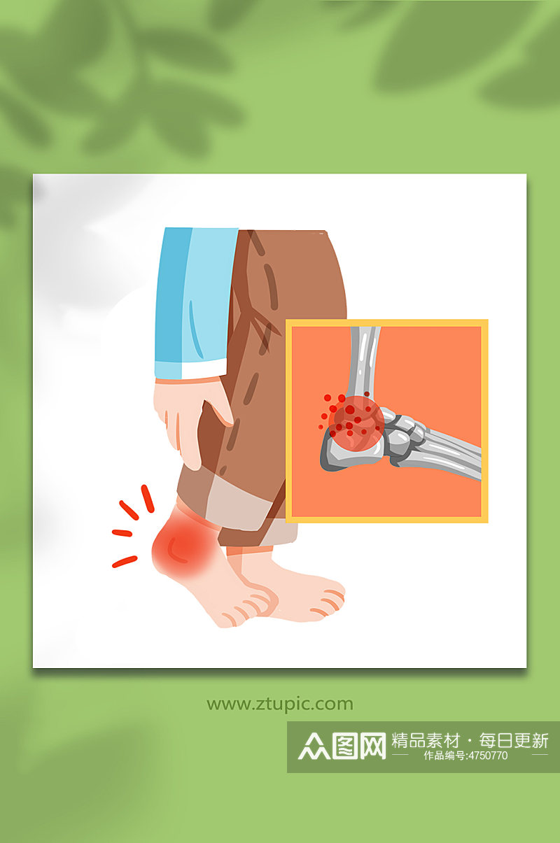 手绘扁平可爱脚踝关节炎关节炎医疗元素插画素材
