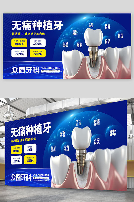 无痛种植牙牙齿牙科宣传展板