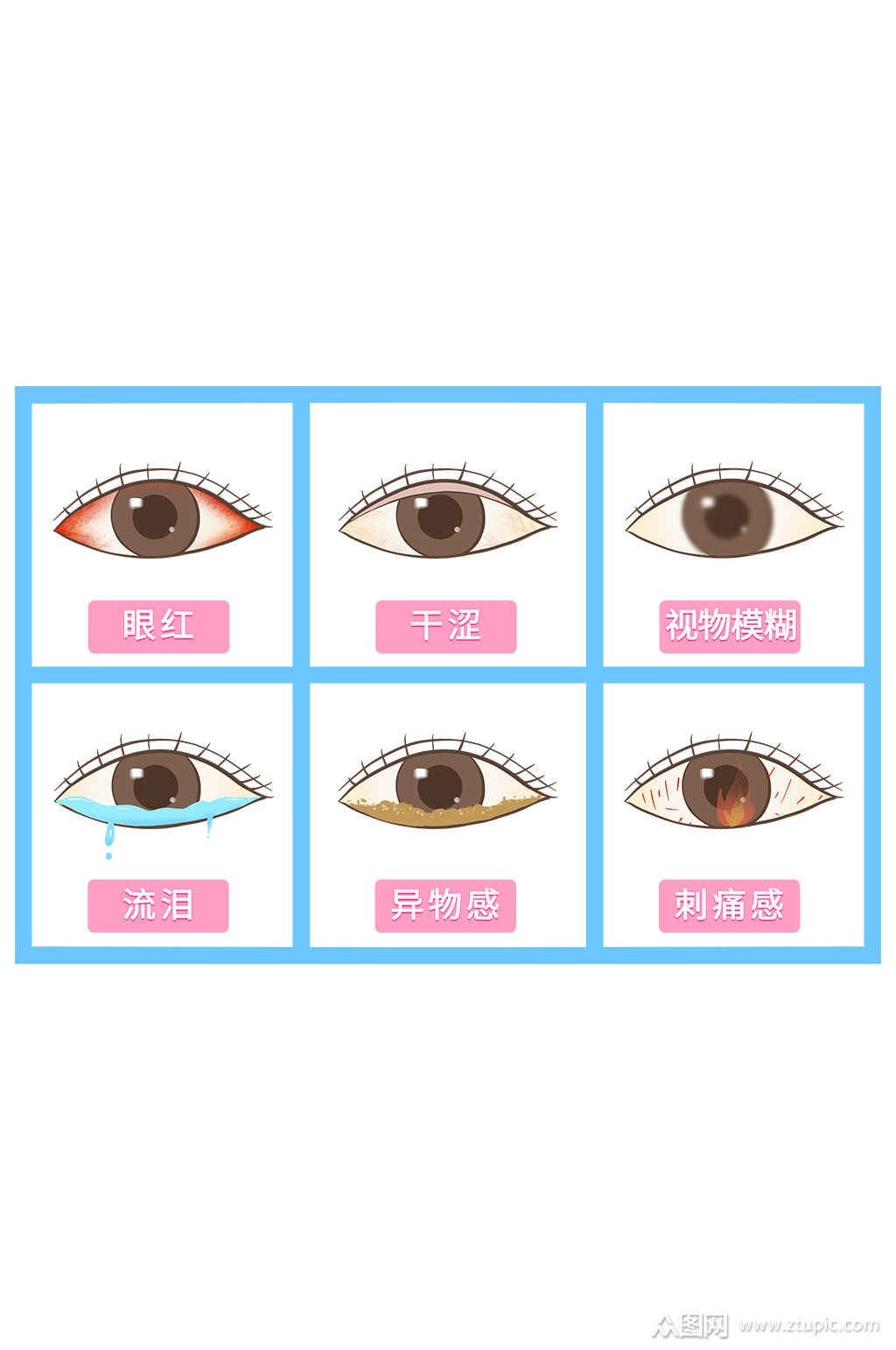 手绘科普眼睛不适的一系列症状
