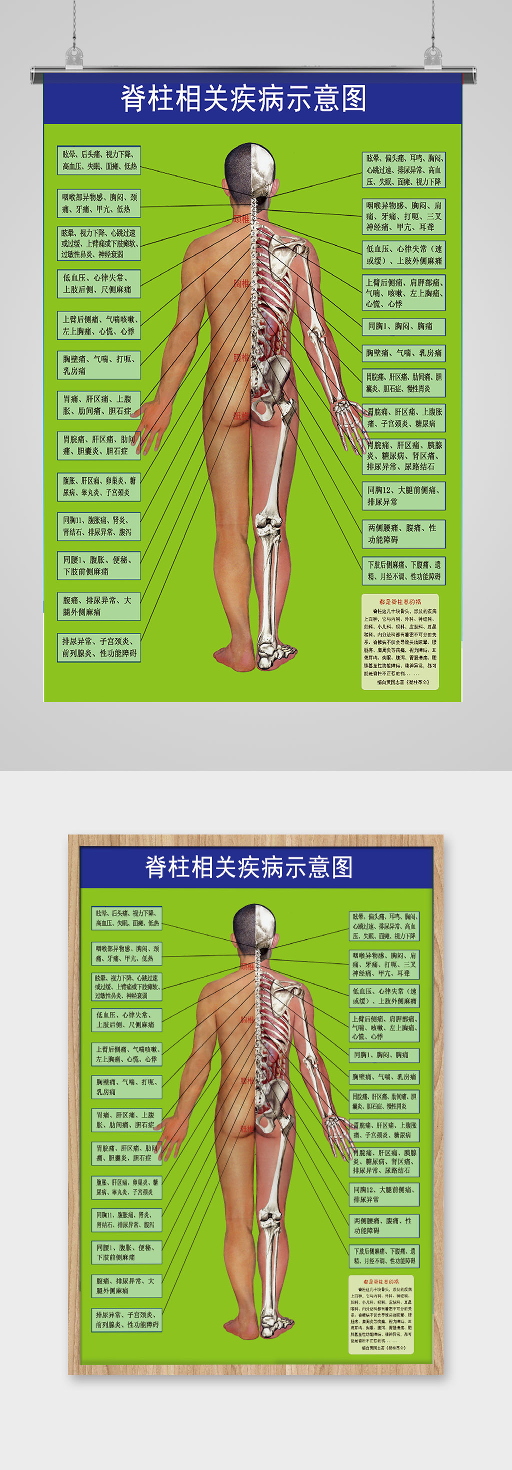 脊柱相关疾病示意图素材
