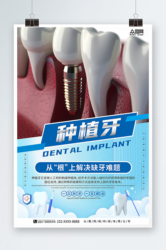 解决缺牙难题种植牙牙齿牙科宣传海报