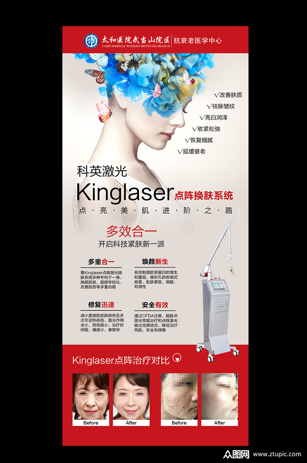 点阵激光美容宣传展架