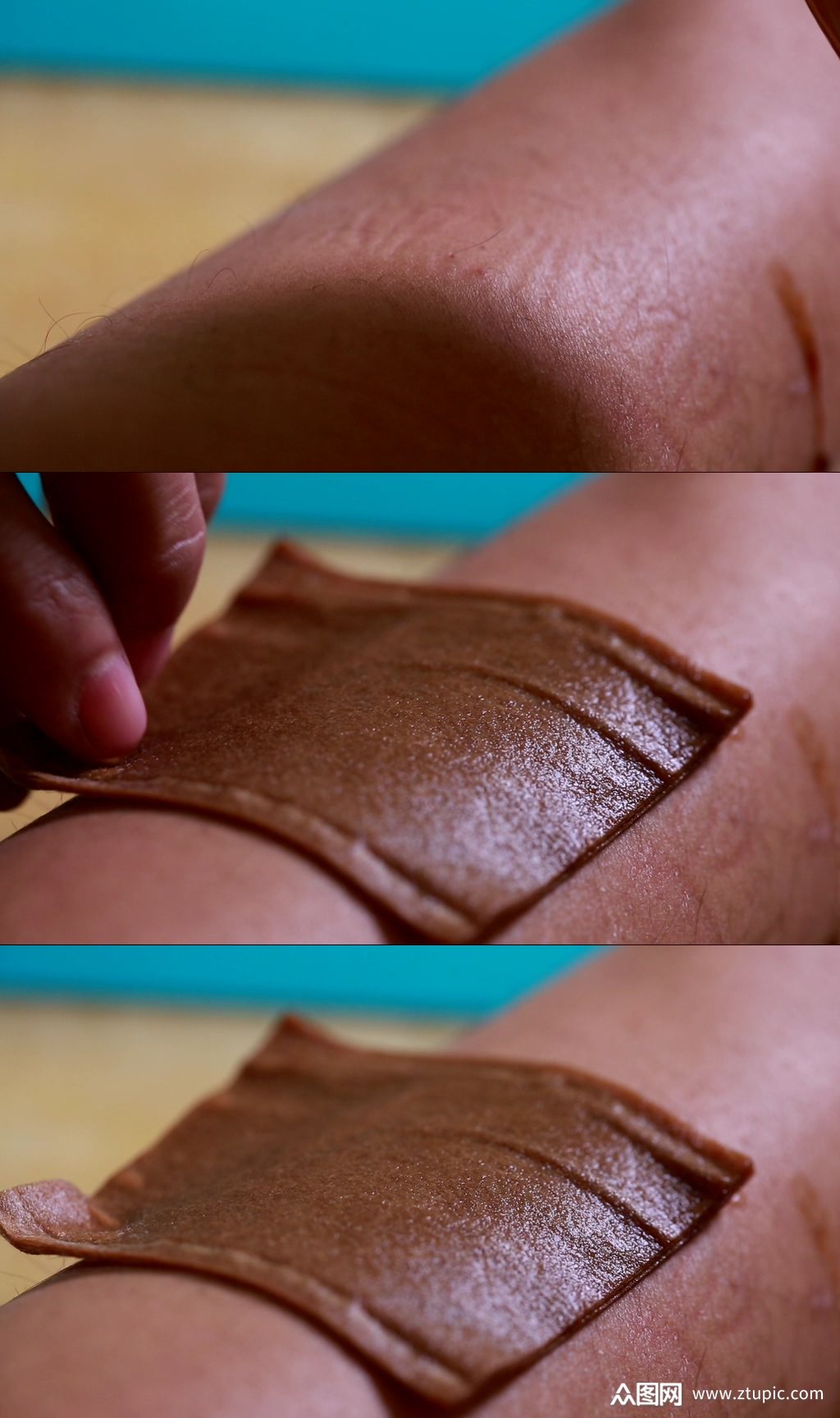 过敏皮炎湿疹擦药偏方实拍