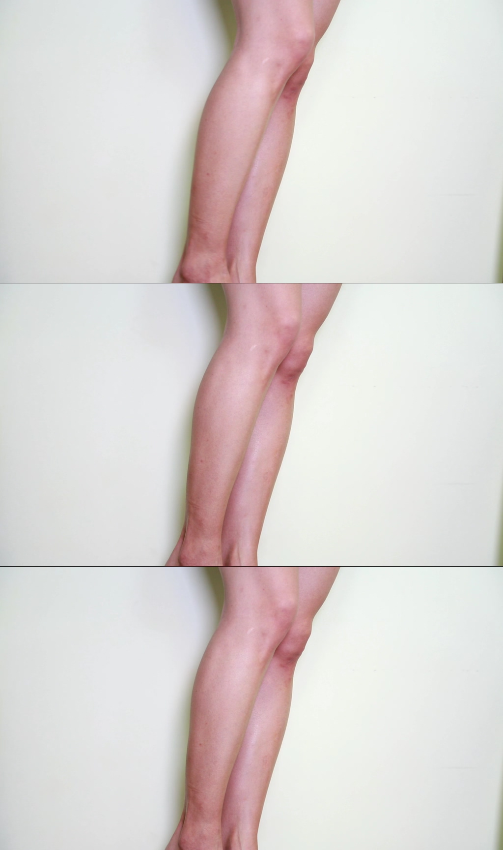 女性腿部穴位按摩膝盖实拍素材