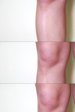 女性腿部穴位按摩膝盖视频