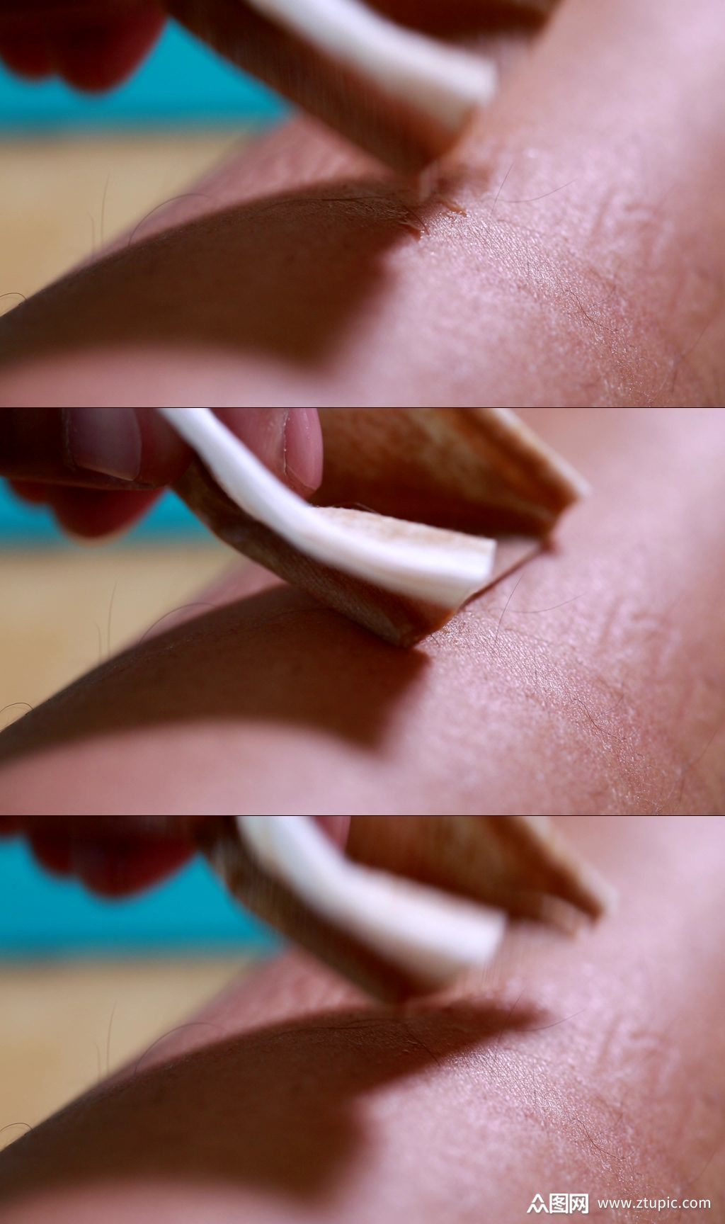 过敏皮炎湿疹擦药偏方实拍