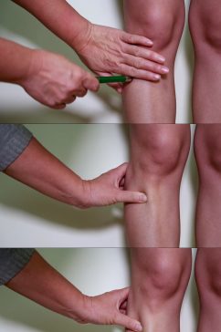 膝盖穴位半月板膝关节按摩实拍