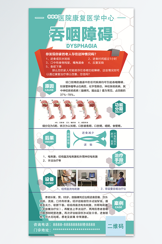医院吞咽障碍易拉宝