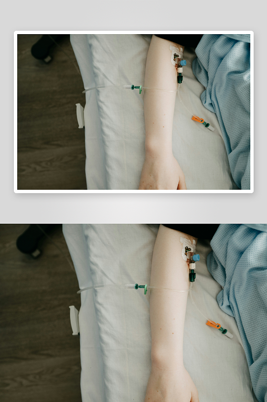 手臂静脉输液治疗场景-众图网