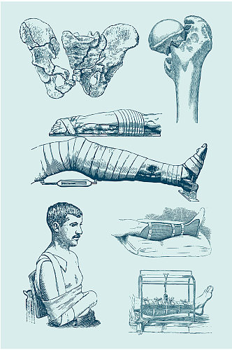 骨骼受伤人物素描绷带救治医学矢量免扣元素