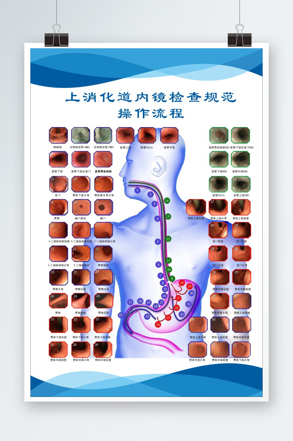 胃肠镜检查流程图图片