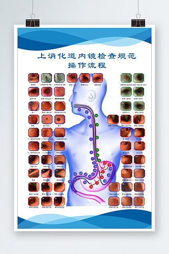 上消化道内镜检查规范操作流程