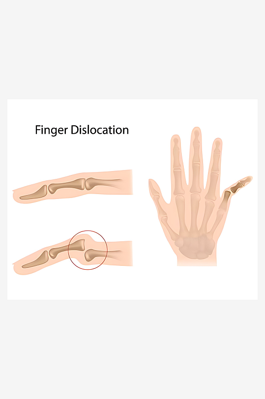 医学医疗人体示意图-众图网