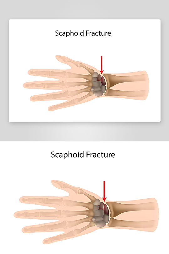 医学医疗人体示意图-众图网