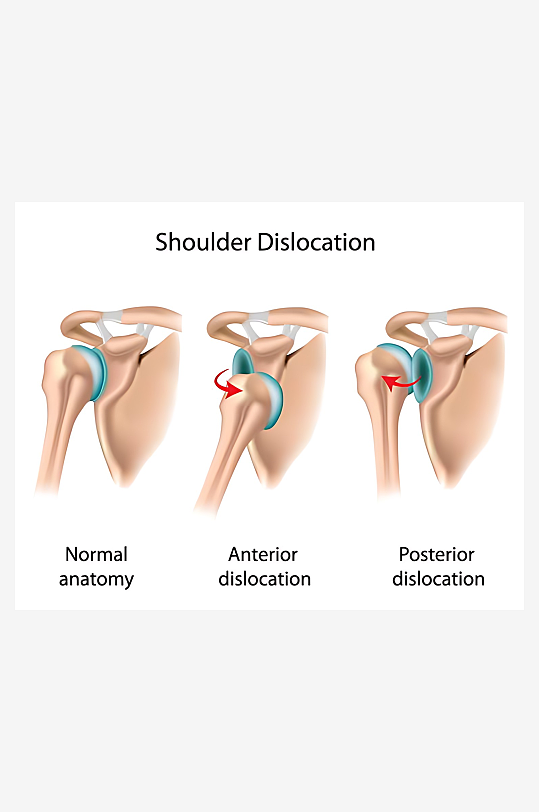 医学医疗人体示意图-众图网