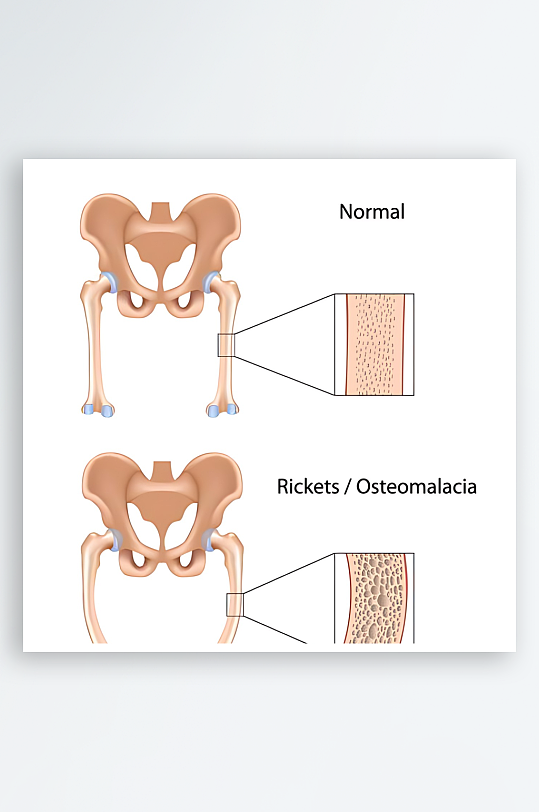 医学医疗人体示意图-众图网