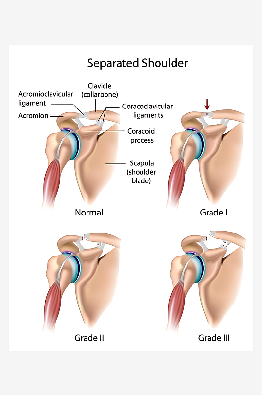 医学医疗人体示意图-众图网