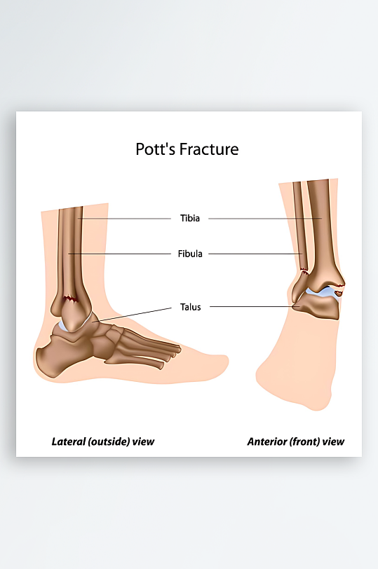 医学医疗人体示意图-众图网