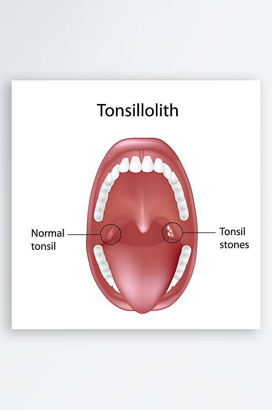 医学医疗人体示意图-众图网