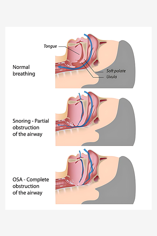医疗医学人体示意图-众图网