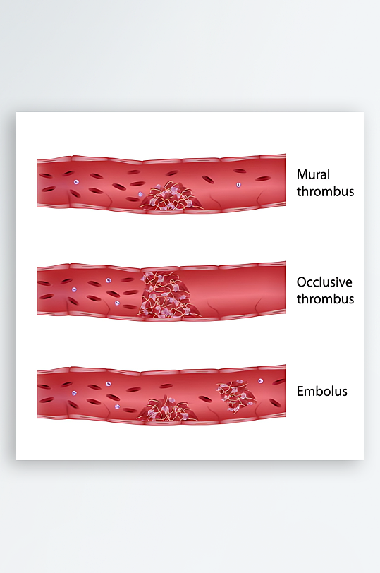 医疗医学人体示意图-众图网