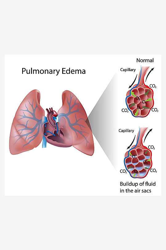 医疗医学人体示意图-众图网