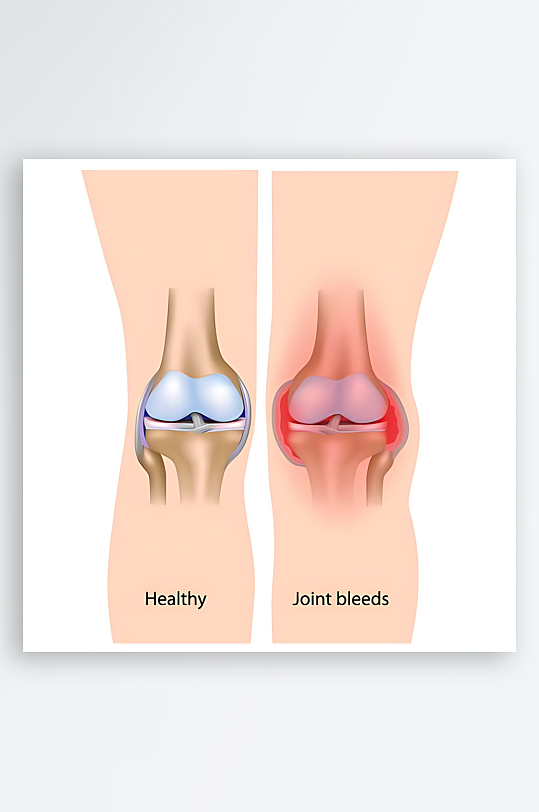 医疗医学人体示意图-众图网