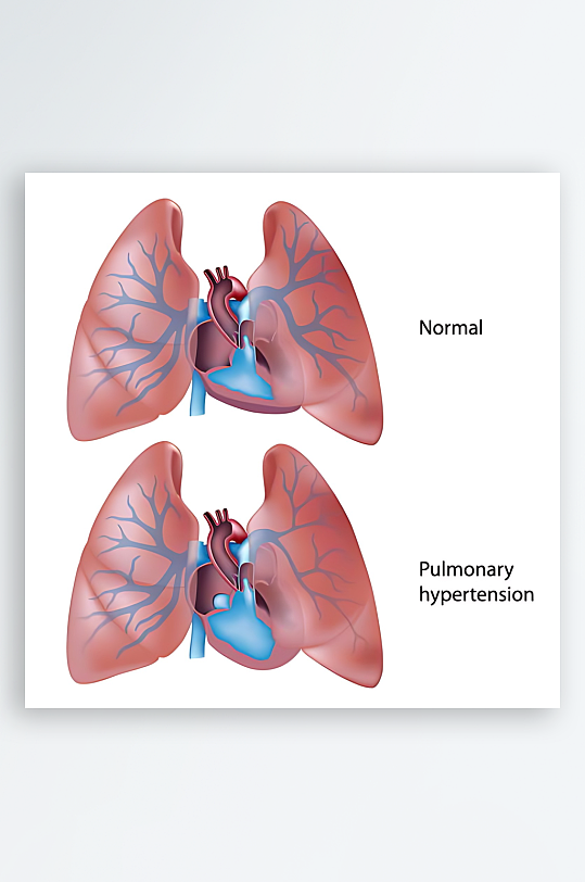 医疗医学人体示意图-众图网