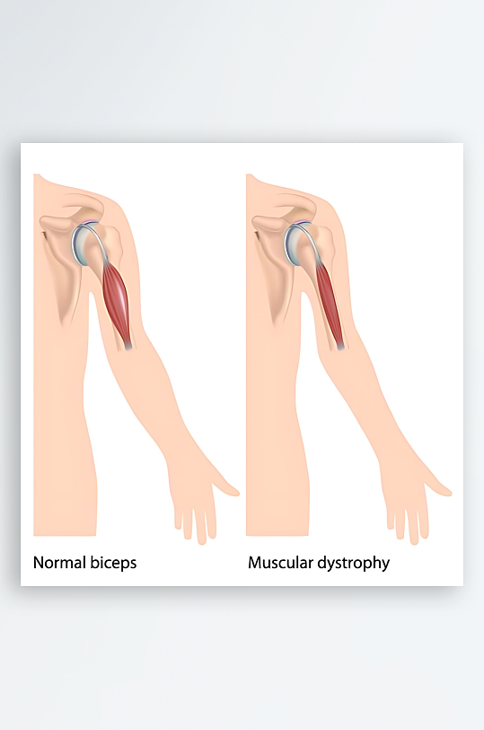 医学医疗人体示意图-众图网